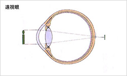 遠視眼