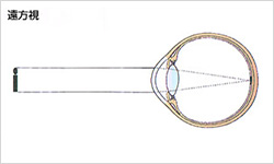 遠方視